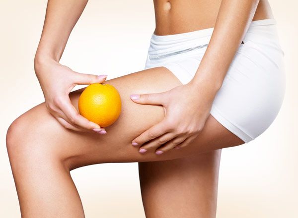 celulitis_tratamientos_RibeClinic