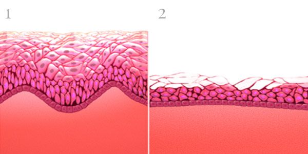Mucosa vaginal