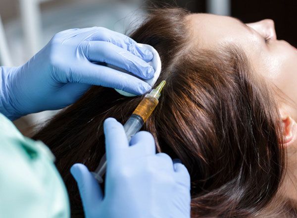 Tratamiento mesoterapia Capilar