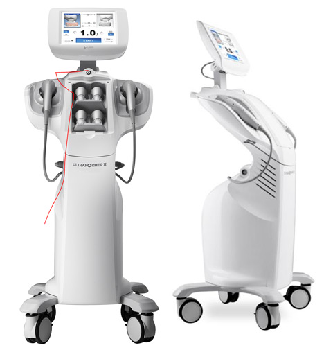 HIFU ultraformer III