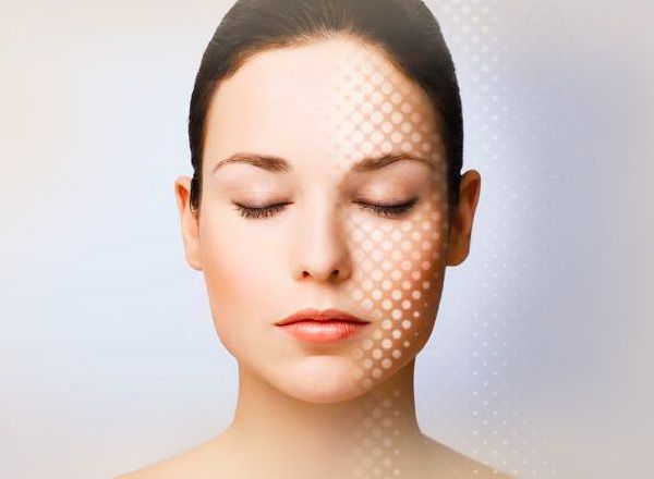 Tratamientos flacidez facial